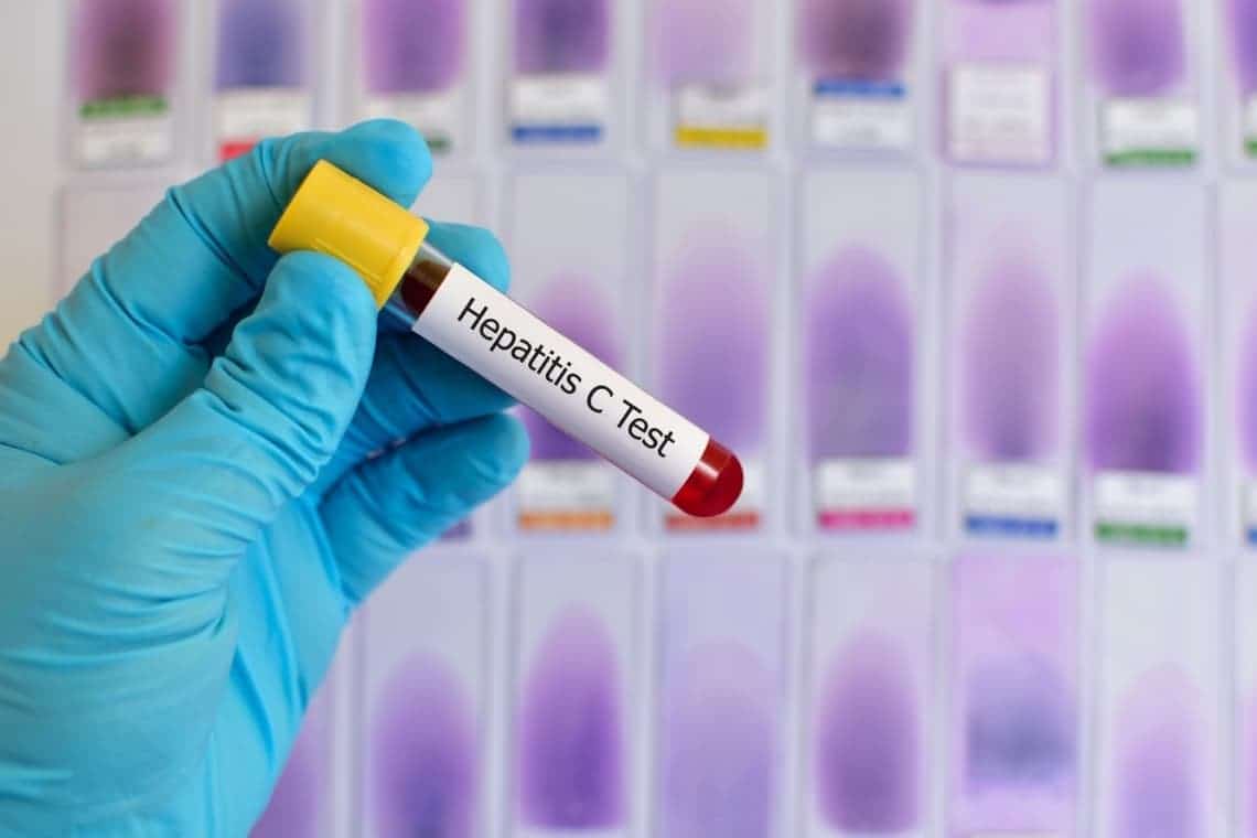 Campanie de testare pentru depistarea hepatitelor virale B/D și C în județul Prahova
