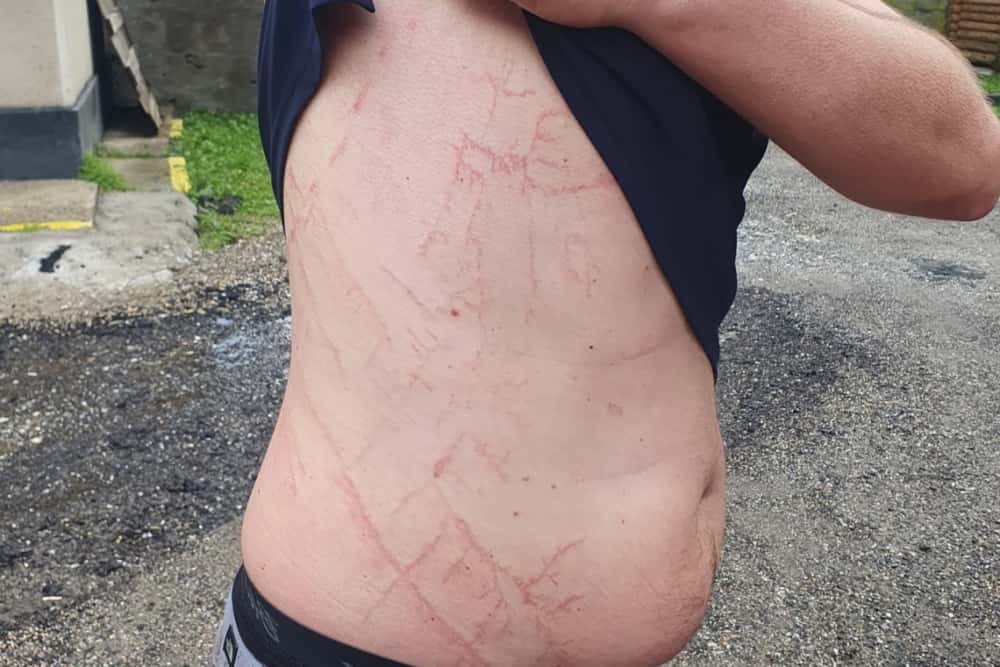 Un bărbat a scăpat ca prin minune cu viață după ce un fulger s-a descărcat în apropierea sa, pe munte!