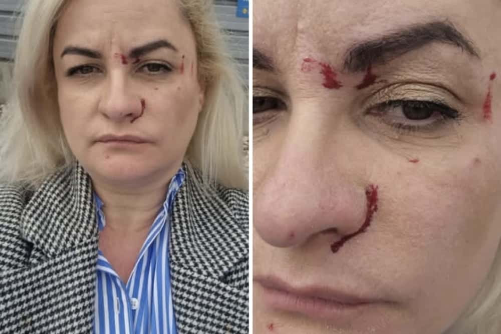 UPDATE/ Bătăușul care a lovit o femeie și un bărbat, în parcarea magazinului LIDL de pe strada Apelor din Ploiești, cercetat de poliție